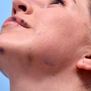 Complications Training Course Online