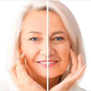 MESO BOTO-Xtreme + Master Course